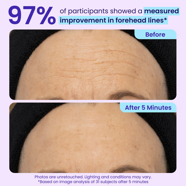 Skin Problems Aren’t “Normal Aging” — They May Be Warning Signs Your Skin Is Losing Its Ability to Repair