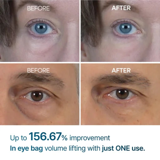 Seurico™ Advanced Firming Under-Eye Cream