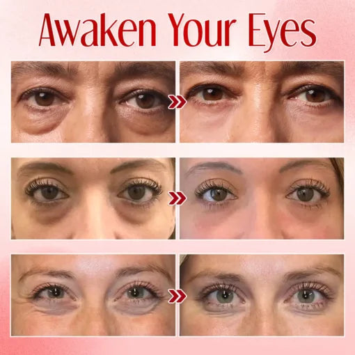 Seurico™ Instant Eye Bag Eraser
