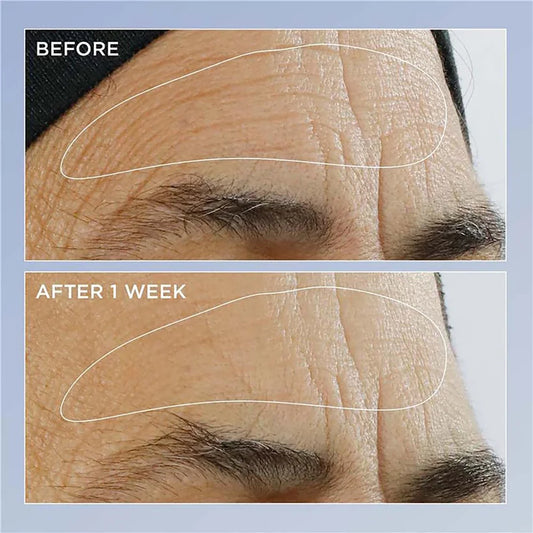 Triple Retinol Renewal Serum Duo