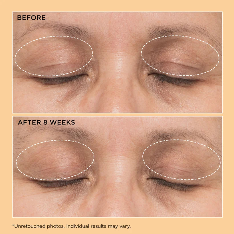 Neuropeptide Lift & Correct Duo