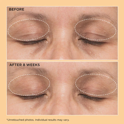 Neuropeptide Lift & Correct Duo