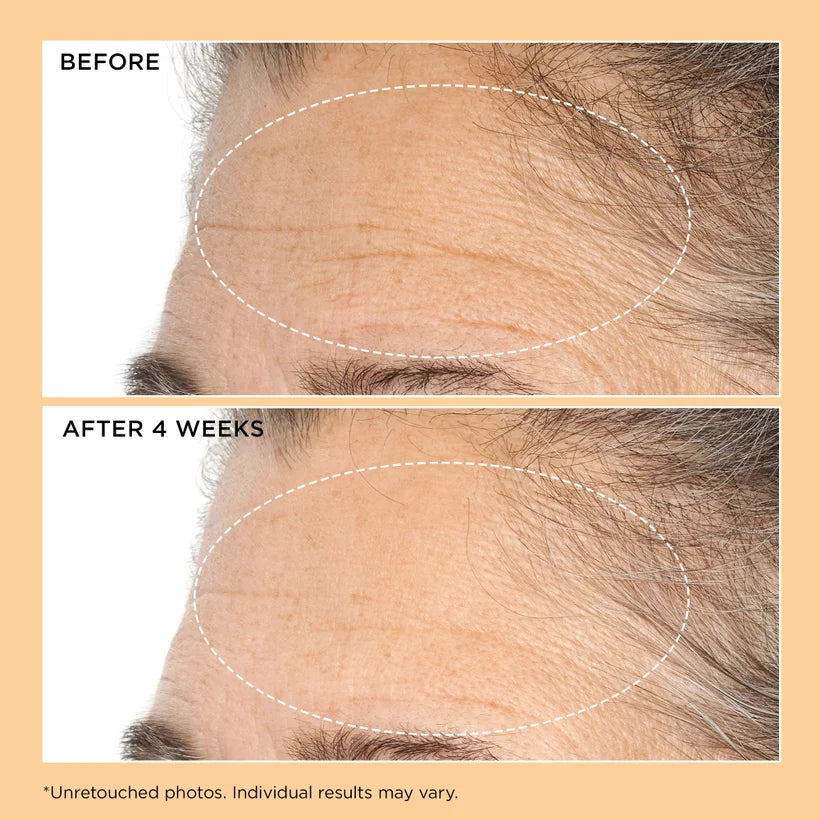 Neuropeptide Lift & Correct Duo