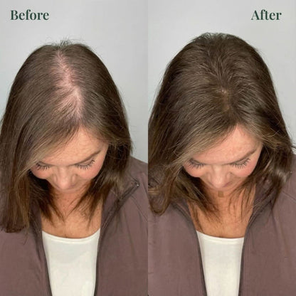 Kerarose™ Growth Support Shampoo
